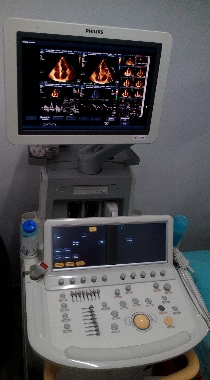 Ecocardiograma con Dobutamina